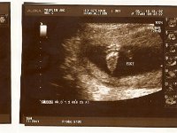 18 weeks  Sammy's little brother!