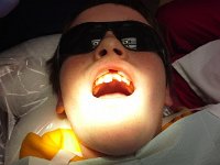20151130 144258  Getting teeth repaired. I think this story is online. Look up Thanksgiving weekend. It was a whipped cream fight!