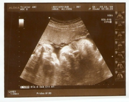 ben-32wks-2.jpg